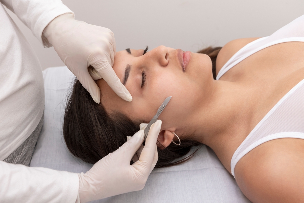 Dermaplaning